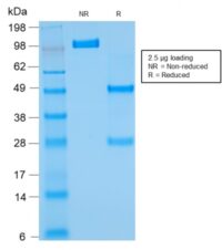 Data from SDS-PAGE analysis of Anti-Bcl-2 antibody (Clone rBCL2/782). Reducing lane (R) shows heavy and light chain fragments. NR lane shows intact antibody with expected MW of approximately 150 kDa. The data are consistent with a high purity, intact mAb.